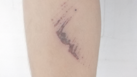 暑期寶寶意外傷護理，漓峰過氧化氫消毒液意想不到的秘密！