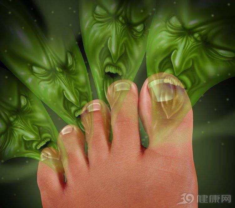 腳臭、腳癢、腳汗、腳脫皮怎么辦？足之友抗菌液-徹底拯救腳臭尷尬！