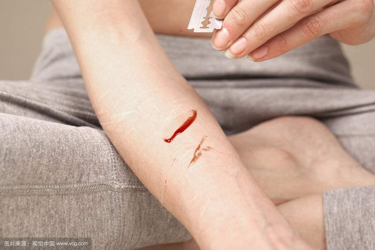 醫(yī)用酒精和碘伏消毒液應(yīng)該怎么選擇？[漓峰]