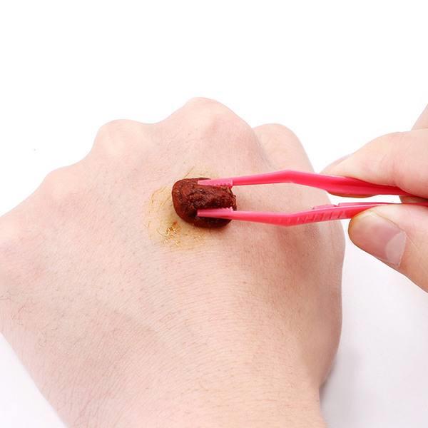 碘伏棉球放干了，應(yīng)該加醫(yī)用酒精，還是碘伏消毒液？[漓峰]