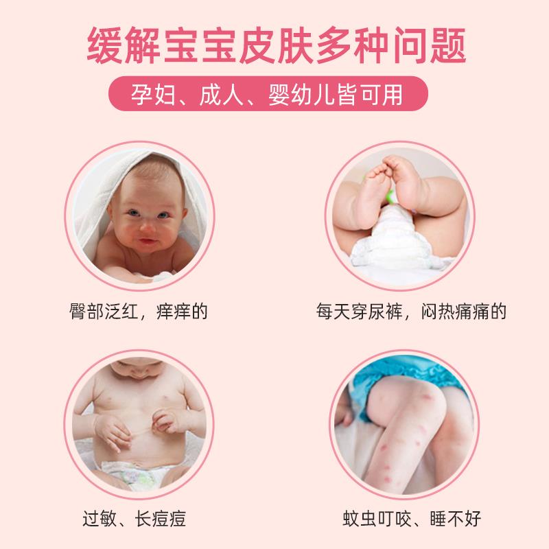 什么情況下可以  給寶寶涂爐甘石洗劑？